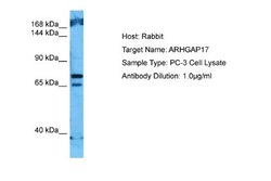 ARHGAP17 Rabbit anti-Human, Polyclonal, Novus Biologicals 0.1ml; Unconjugated:Antibodies,